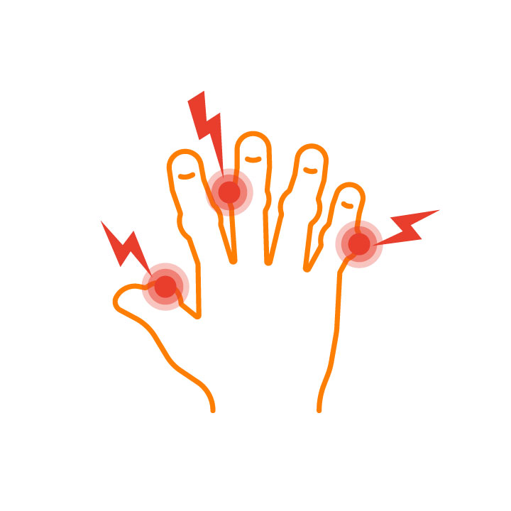 Extra-articular rheumatism