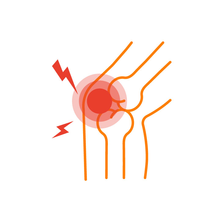 Post-traumatic inflammation
