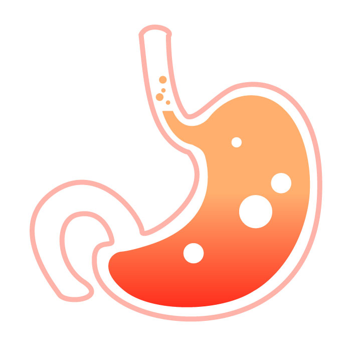 Treatment of heartburn and acid reflux