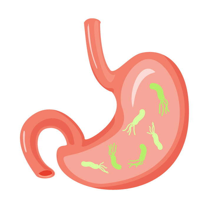 Helicobacter pylori-associated peptic ulcers