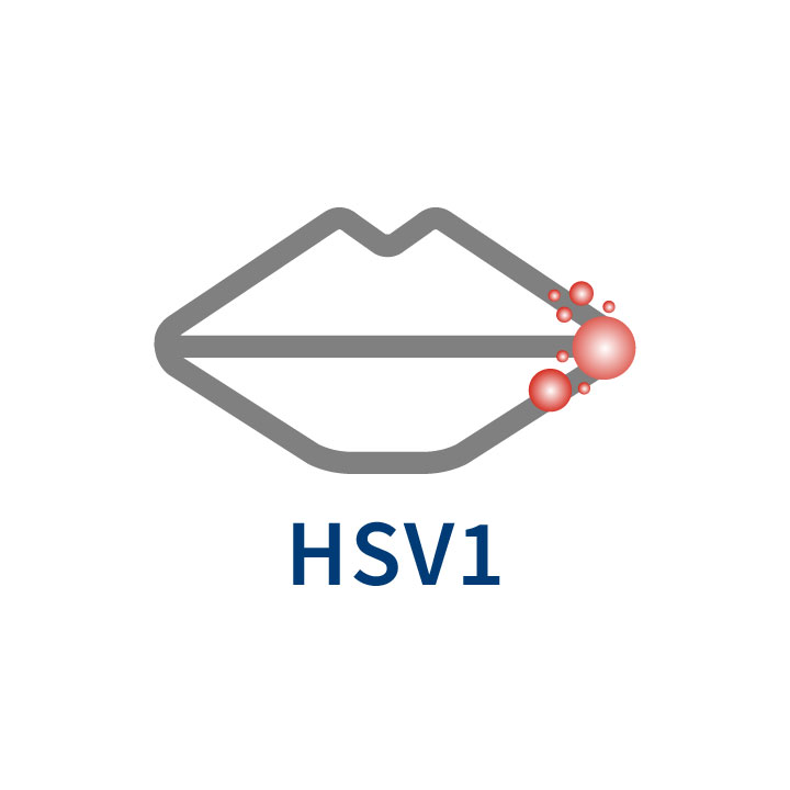 Type 1 Herpes Simplex Virus (HSV-1) commonly causes cold sores and shingles (commonly known as “shingles” or “belt-like rash”).