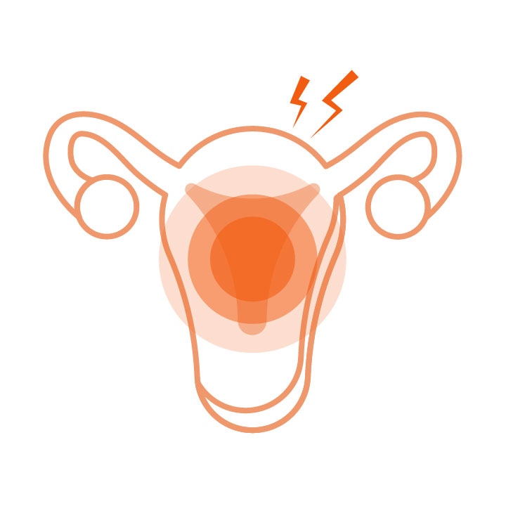 Acute or recurrent vaginal candidiasis