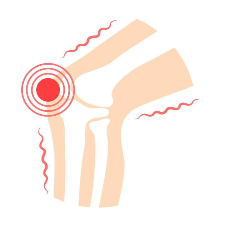 Inflammation, swelling, and pain caused by arthritis or injury.