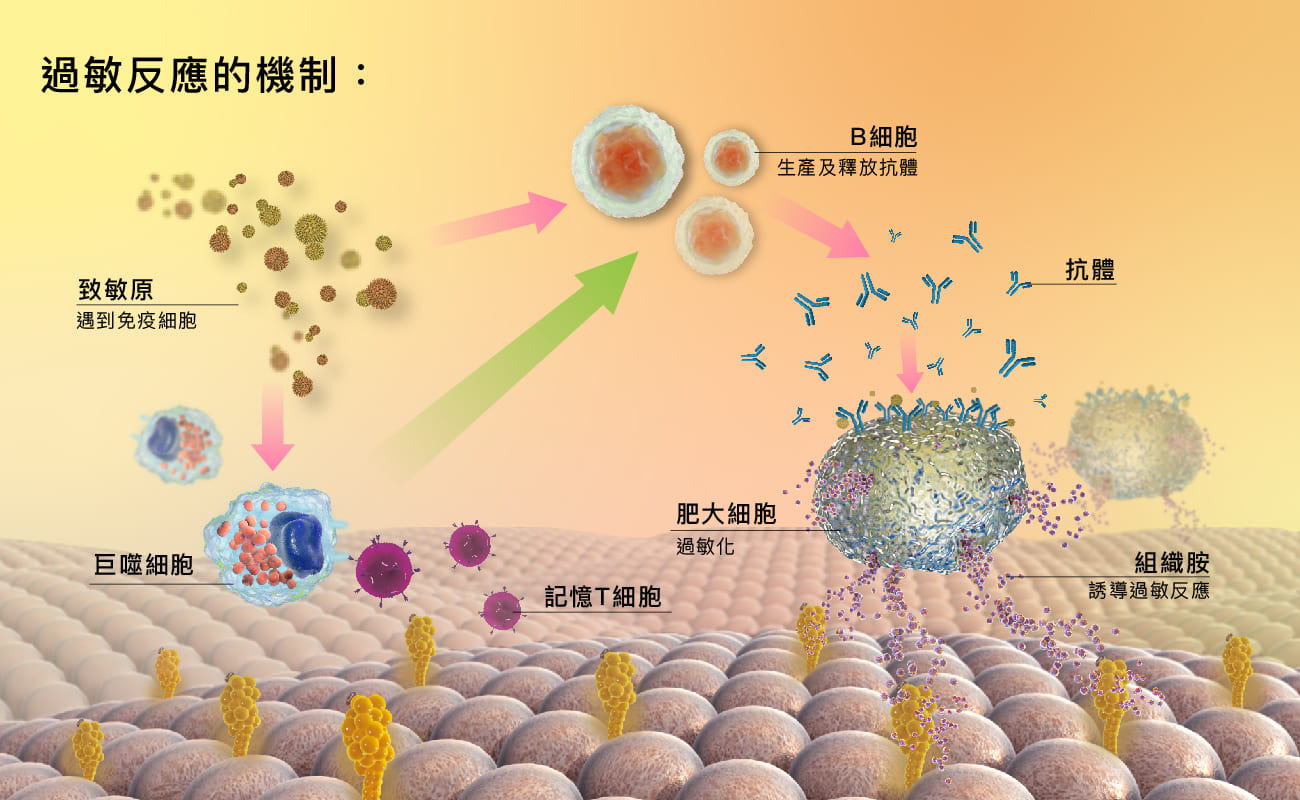 中文過敏反應機制圖解。它顯示過敏原觸發肥大細胞、鉅細胞和 B 細胞。產生抗體並與過敏原結合，導致肥大細胞釋放物質並導致症狀。