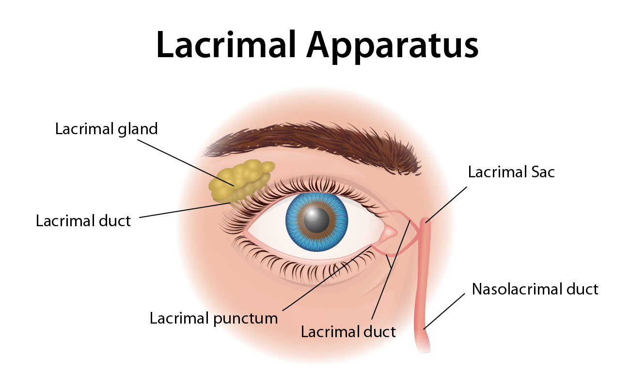 What Is a Blocked Tear Duct?