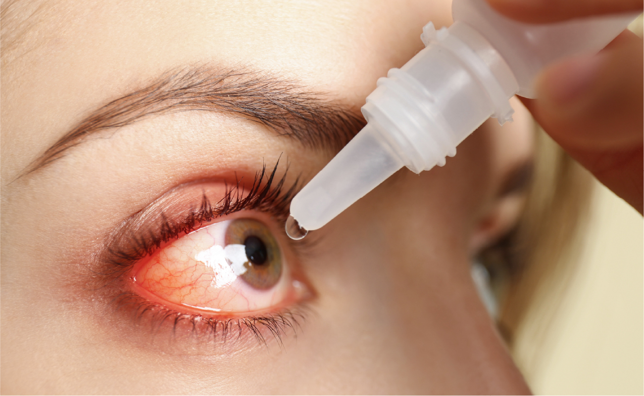 How Long Does Dry Eye Take to Heal?