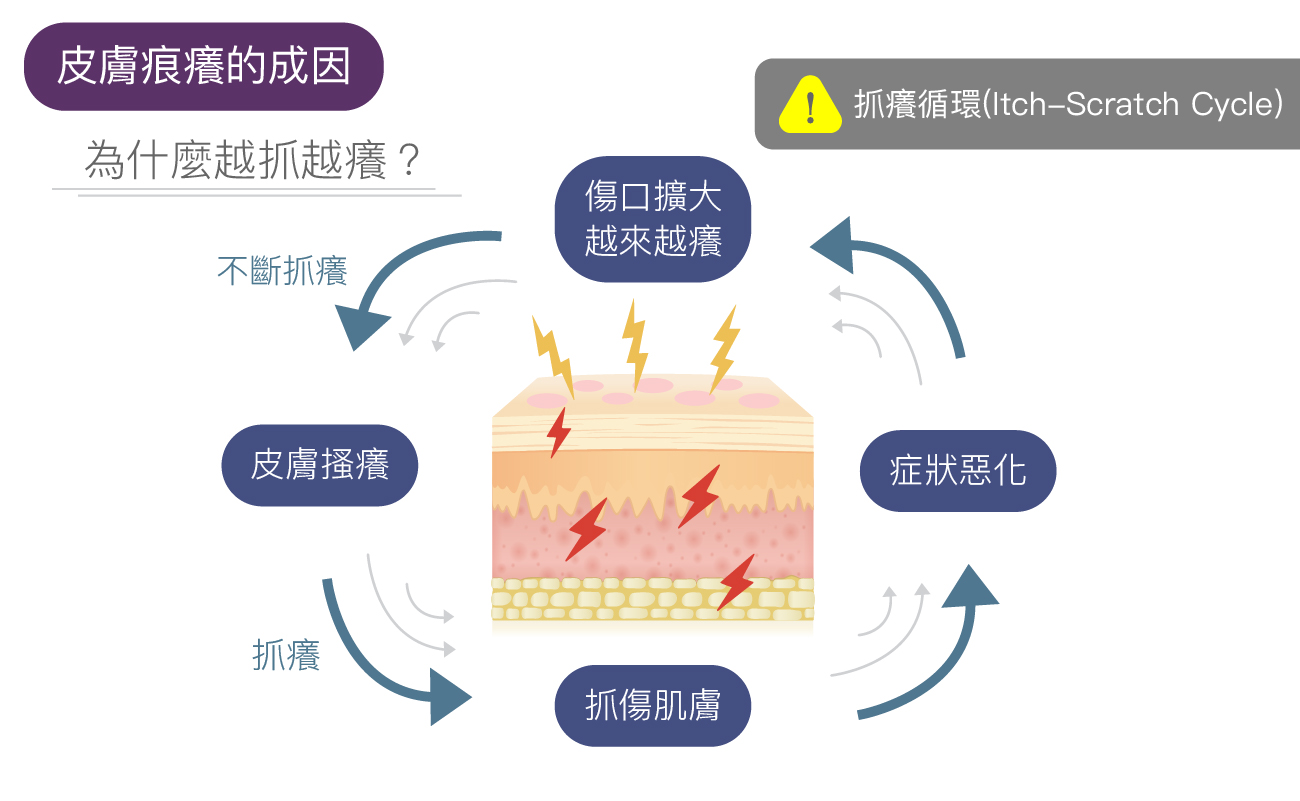 為什麼你的皮膚越𢯎越痕