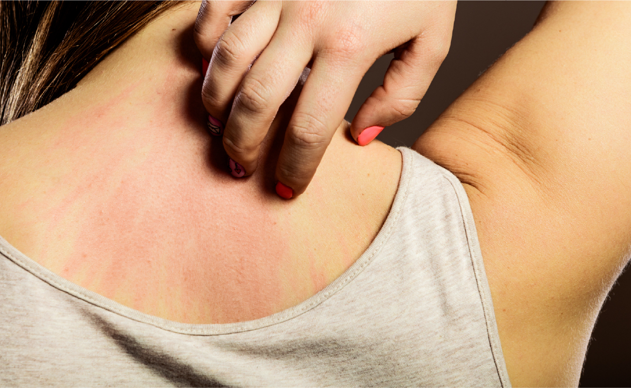 What Causes Itchy Skin?
