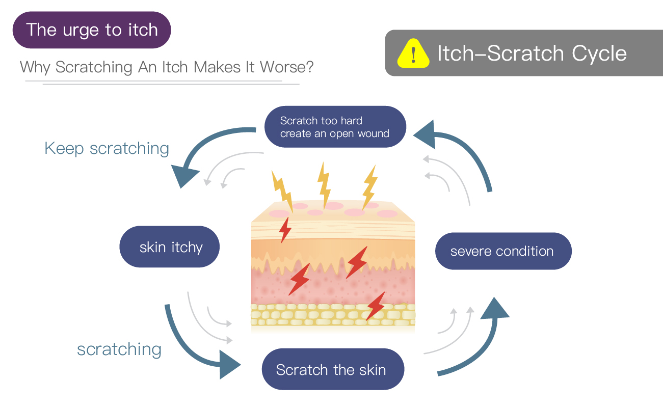 Why Does Scratching Make Itchy Skin Worse?