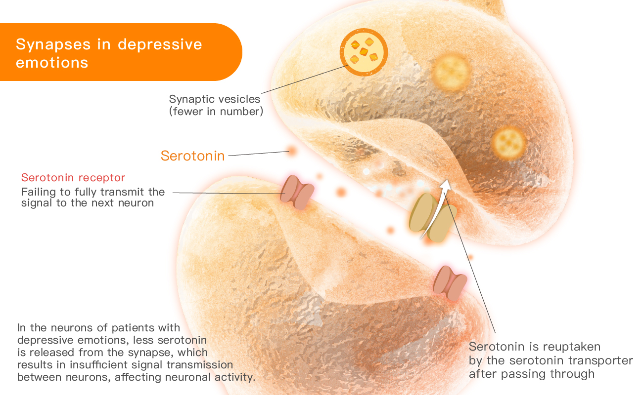 The Impact of High Cortisol Levels