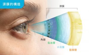 為什麼滴了人工淚液還是眼乾