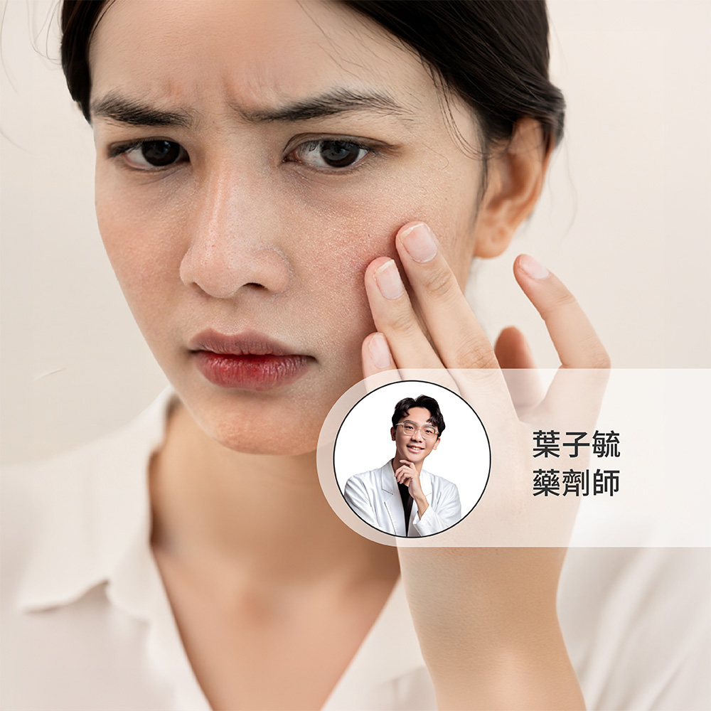 女性觸摸受損乾燥的臉部肌膚，附藥劑師葉子毓專業推薦標示